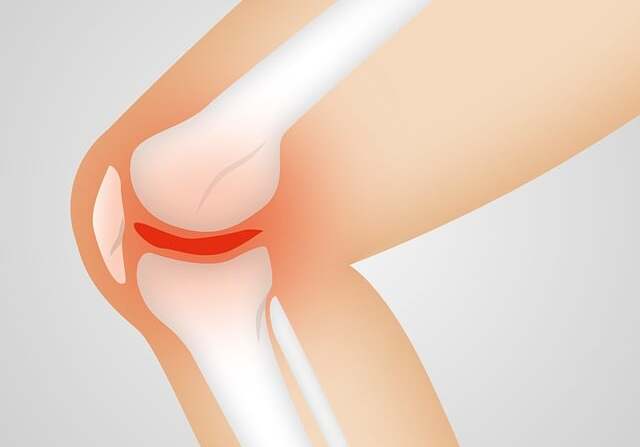 관절염