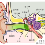 이석증