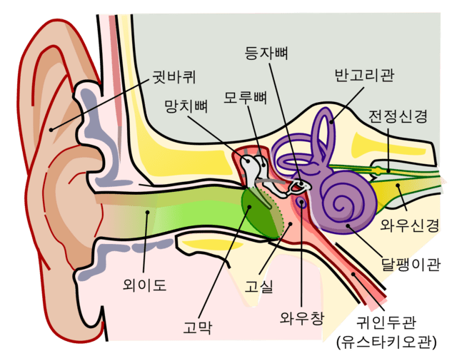 이석증